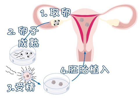 严重少弱精